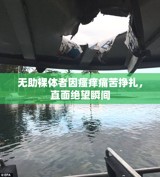 无助裸体者因瘙痒痛苦挣扎，直面绝望瞬间