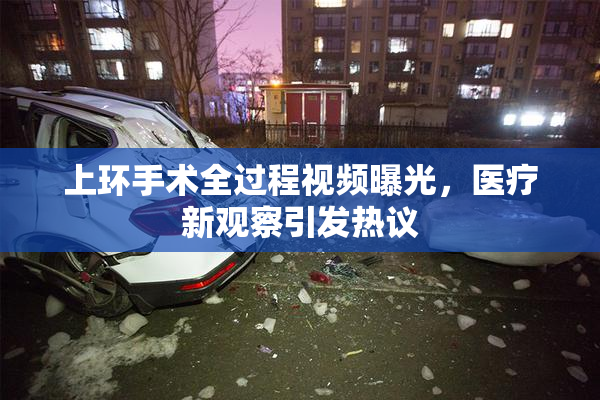 上环手术全过程视频曝光，医疗新观察引发热议