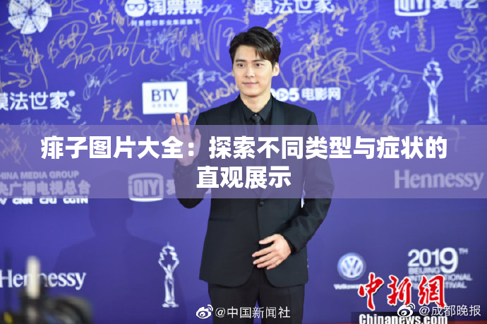 痱子图片大全：探索不同类型与症状的直观展示