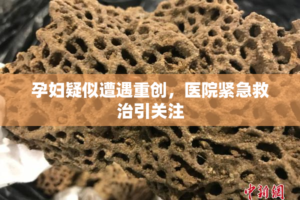 孕妇疑似遭遇重创，医院紧急救治引关注