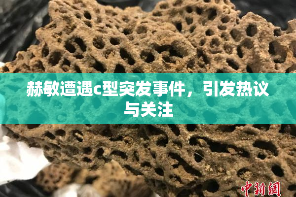 赫敏遭遇c型突发事件，引发热议与关注