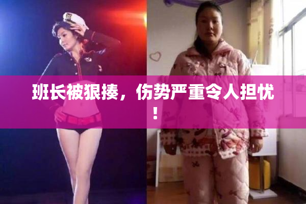 班长被狠揍，伤势严重令人担忧！