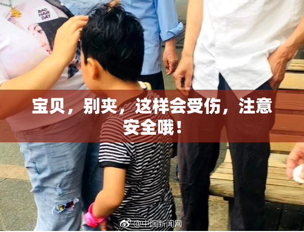 宝贝，别夹，这样会受伤，注意安全哦！