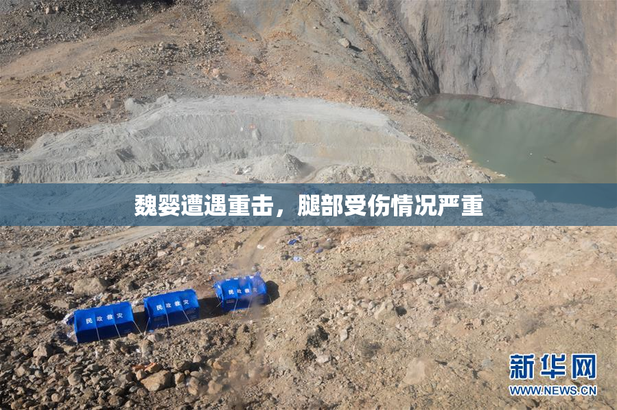 魏婴遭遇重击，腿部受伤情况严重