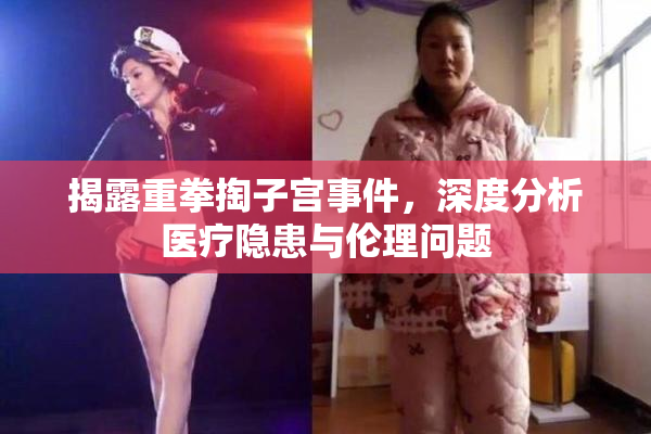 揭露重拳掏子宫事件，深度分析医疗隐患与伦理问题