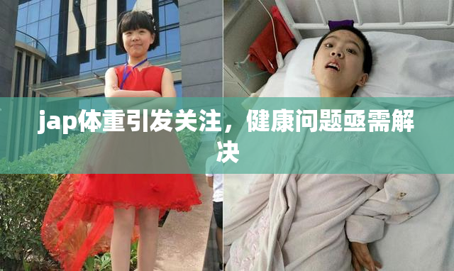 jap体重引发关注，健康问题亟需解决
