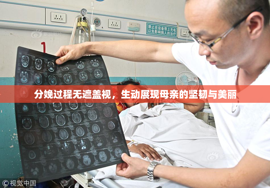 分娩过程无遮盖视，生动展现母亲的坚韧与美丽