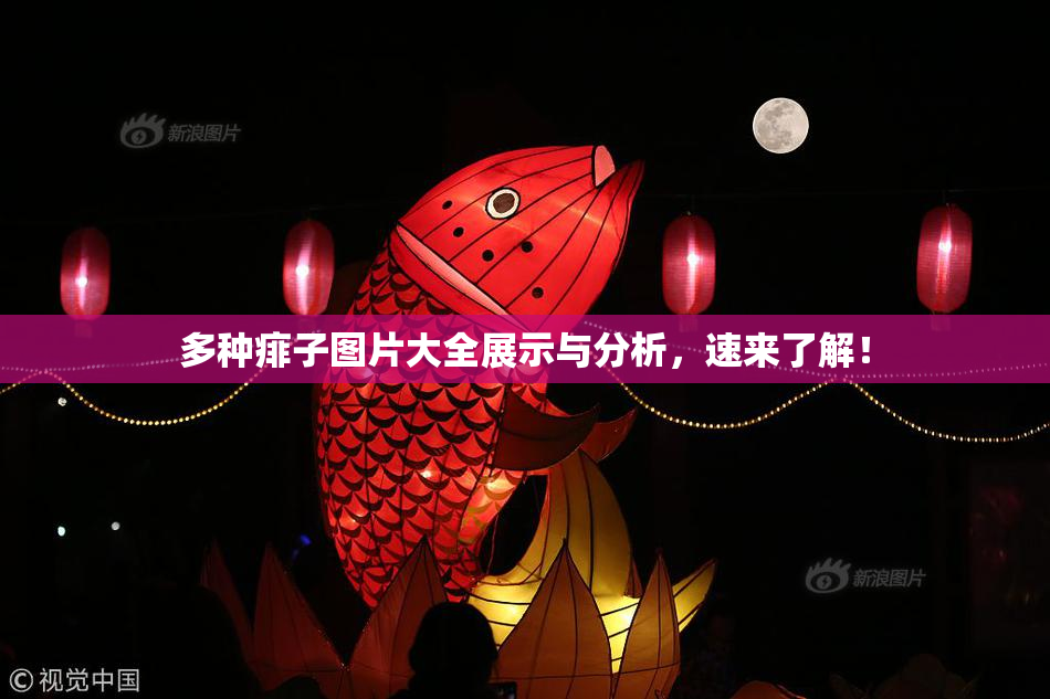 多种痱子图片大全展示与分析，速来了解！