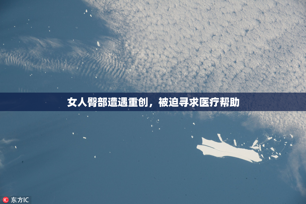 女人臀部遭遇重创，被迫寻求医疗帮助