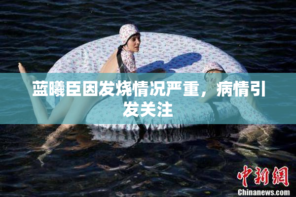 蓝曦臣因发烧情况严重，病情引发关注
