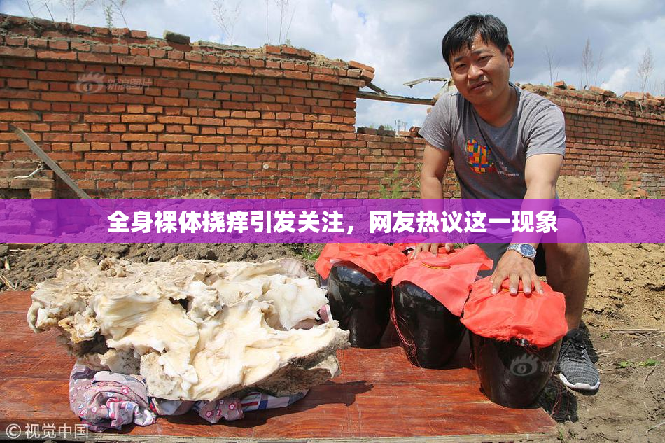 全身裸体挠痒引发关注，网友热议这一现象