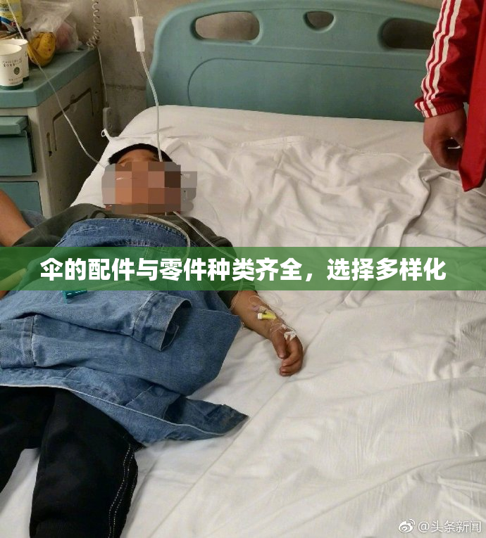 伞的配件与零件种类齐全，选择多样化