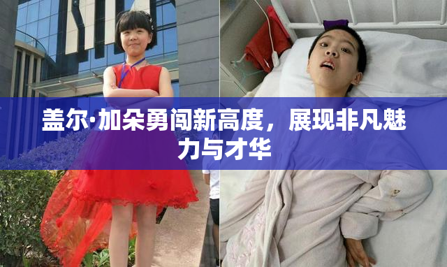 盖尔·加朵勇闯新高度，展现非凡魅力与才华