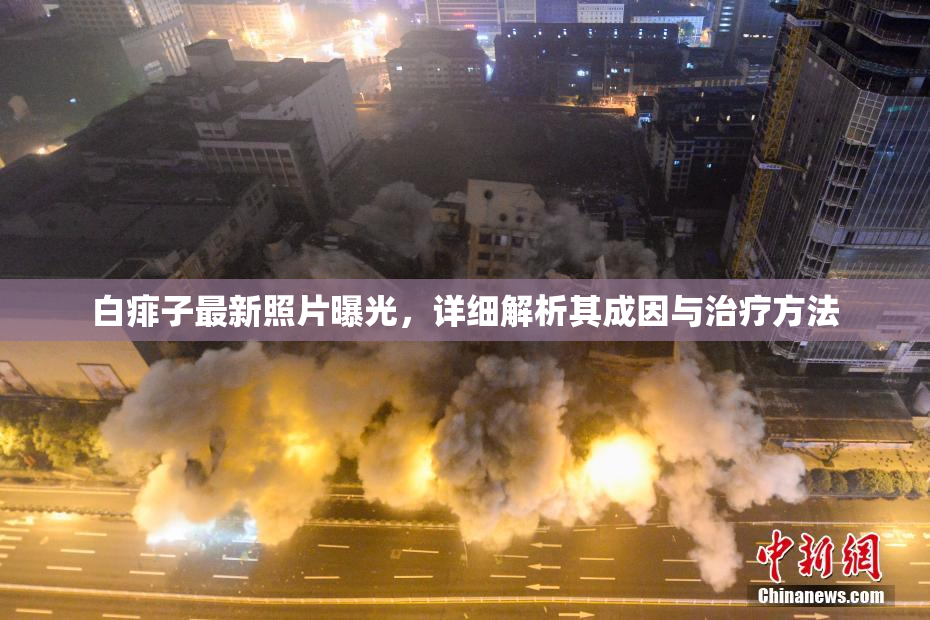 白痱子最新照片曝光，详细解析其成因与治疗方法