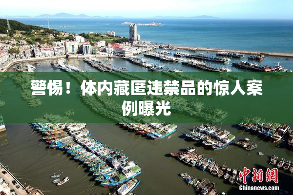 警惕！体内藏匿违禁品的惊人案例曝光