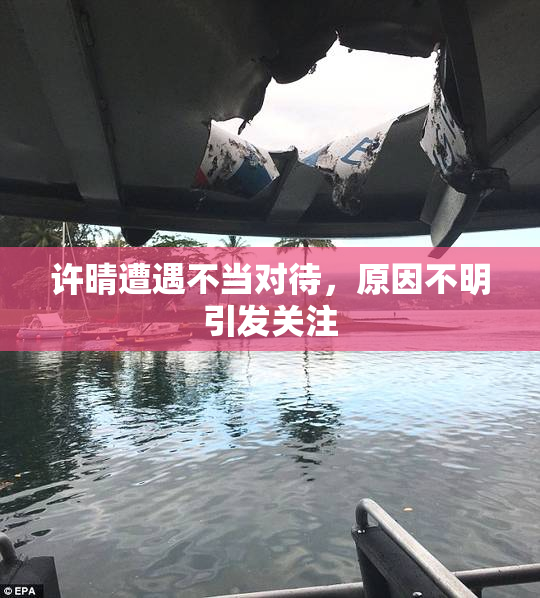 许晴遭遇不当对待，原因不明引发关注